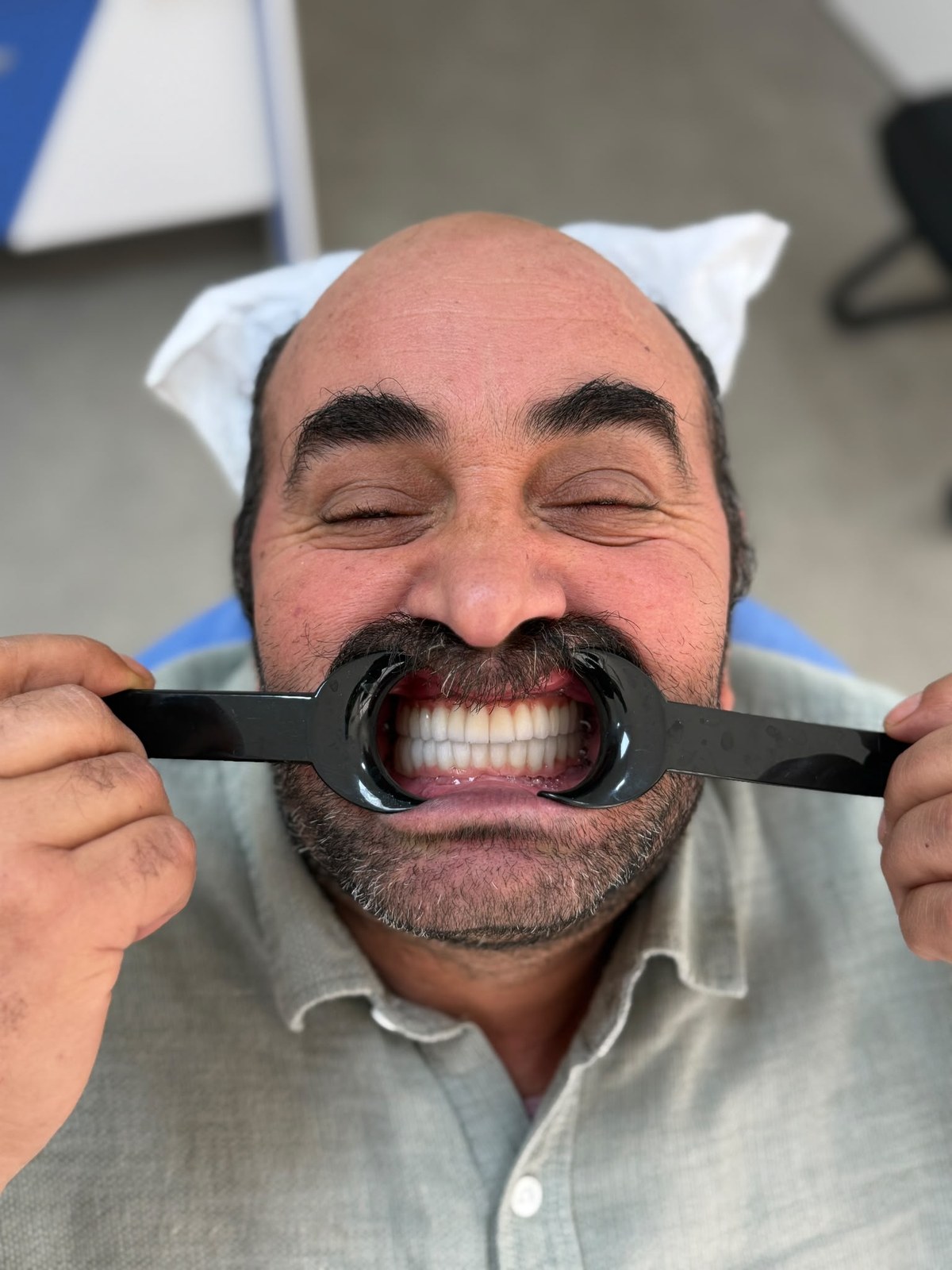 RY Akıncı hasta sonucu 4